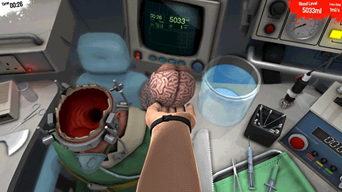 HBB3Aux.gif