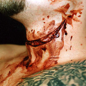 slit%20throat.jpg